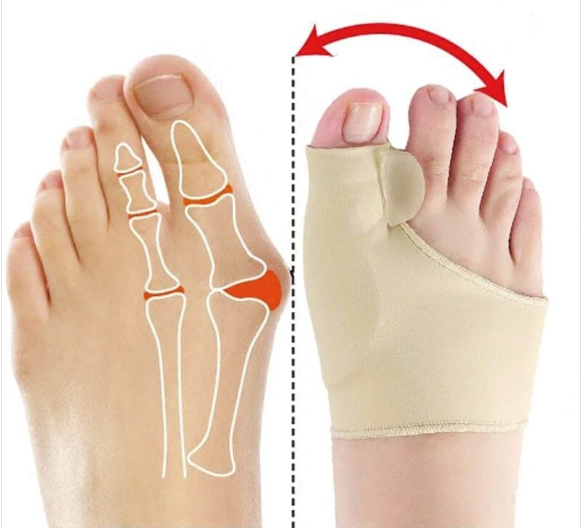 Orthopedic Bunion Corrector (2 pcs)